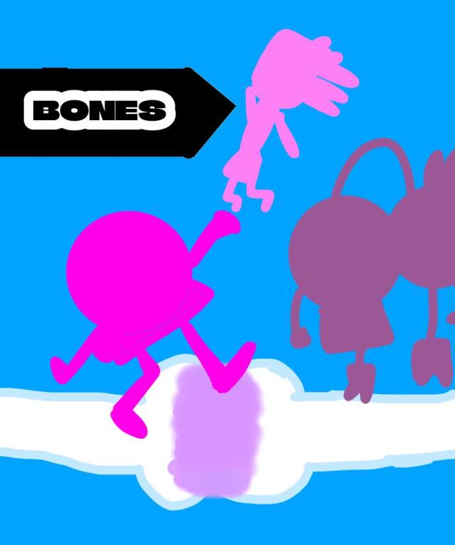 ROR 1: Bones